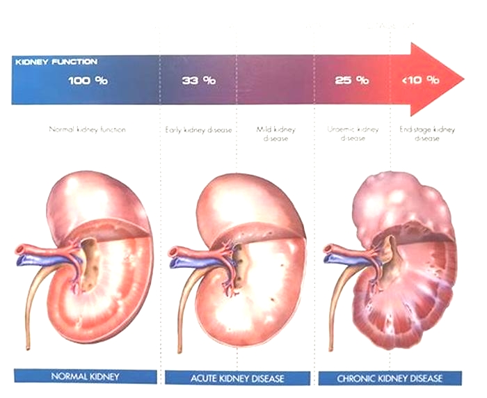 How common is kidney disease in puppies?